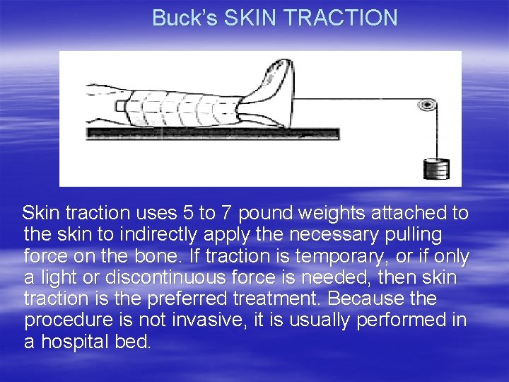 Buck’s SKIN TRACTION Skin traction uses 5 to 7 pound weights attached to the