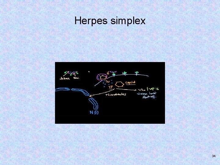 Herpes simplex 34 