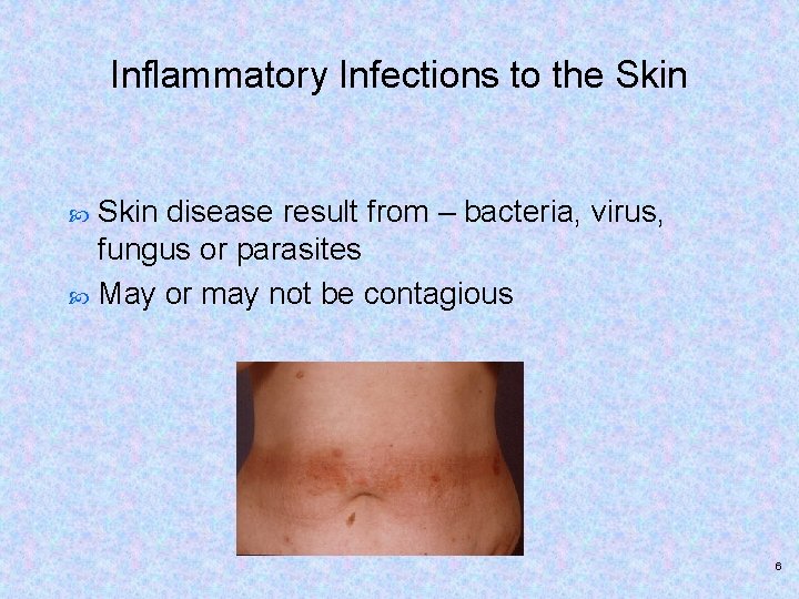 Inflammatory Infections to the Skin disease result from – bacteria, virus, fungus or parasites