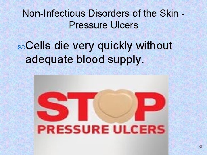 Non-Infectious Disorders of the Skin Pressure Ulcers Cells die very quickly without adequate blood