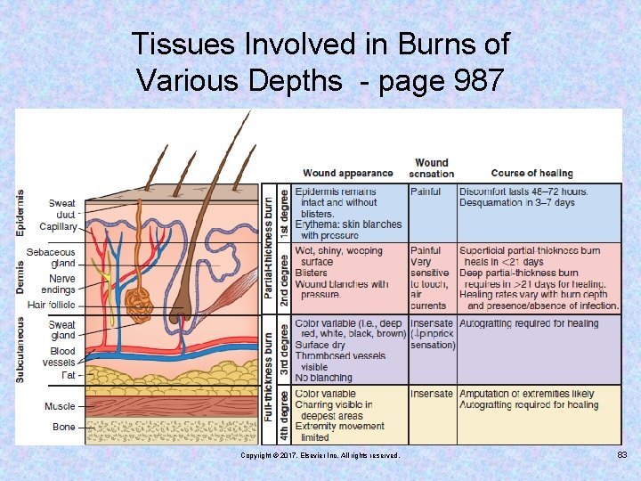 Tissues Involved in Burns of Various Depths - page 987 Copyright © 2017, Elsevier