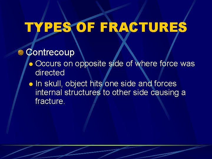 TYPES OF FRACTURES Contrecoup Occurs on opposite side of where force was directed l
