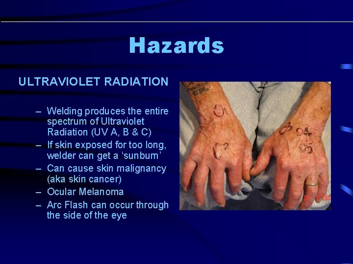 Hazards ULTRAVIOLET RADIATION – Welding produces the entire spectrum of Ultraviolet Radiation (UV A, Hazards ULTRAVIOLET RADIATION – Welding produces the entire spectrum of Ultraviolet Radiation (UV A,