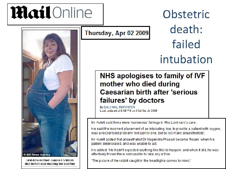 Obstetric death: failed intubation 