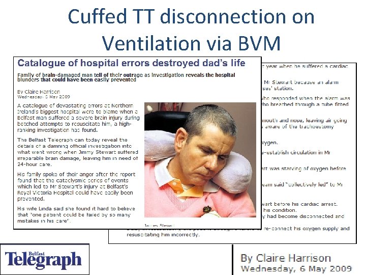 Cuffed TT disconnection on Ventilation via BVM 