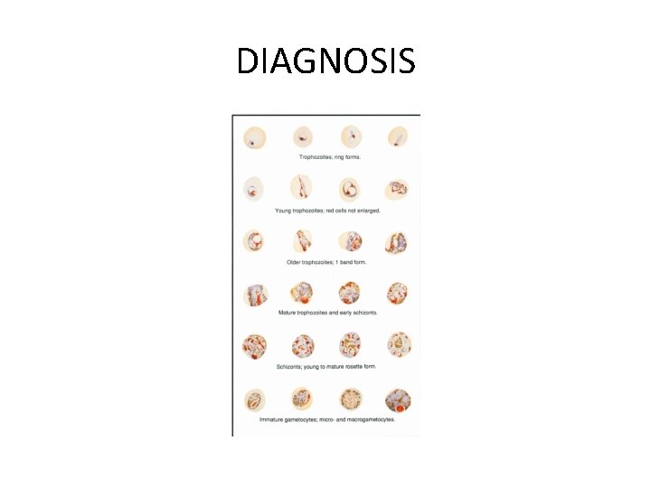 DIAGNOSIS 