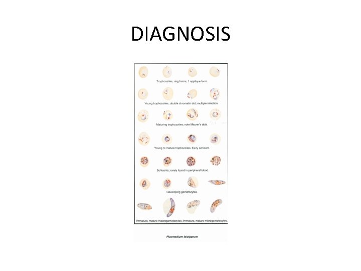 DIAGNOSIS 