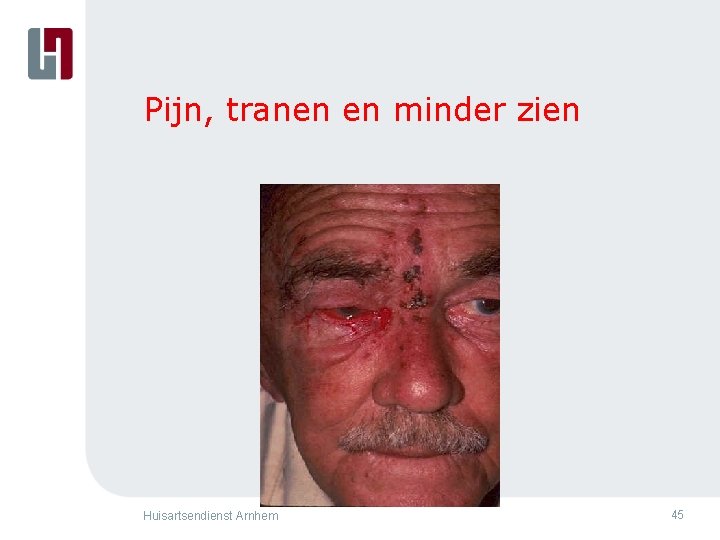Pijn, tranen en minder zien Huisartsendienst Arnhem 45 