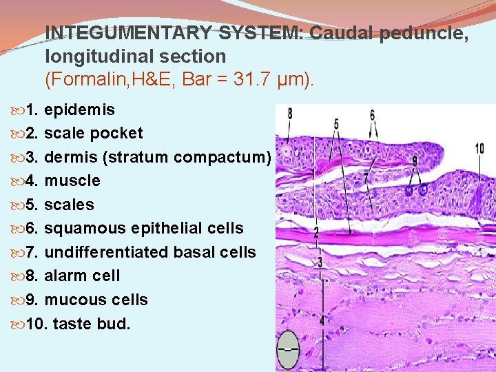 INTEGUMENTARY SYSTEM: Caudal peduncle, longitudinal section (Formalin, H&E, Bar = 31. 7 µm). 1.