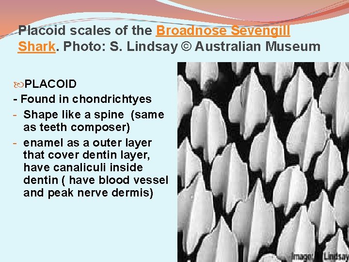 Placoid scales of the Broadnose Sevengill Shark. Photo: S. Lindsay © Australian Museum PLACOID