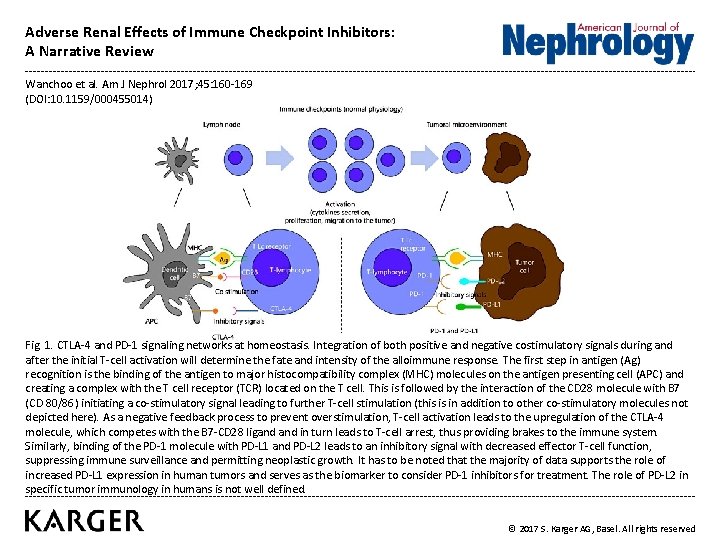 Adverse Renal Effects of Immune Checkpoint Inhibitors A