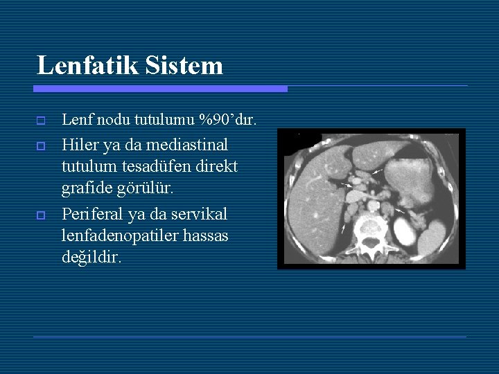 Lenfatik Sistem o Lenf nodu tutulumu %90’dır. o Hiler ya da mediastinal tutulum tesadüfen