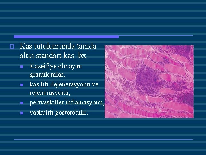 o Kas tutulumunda tanıda altın standart kas bx. n n Kazeifiye olmayan granülomlar, kas