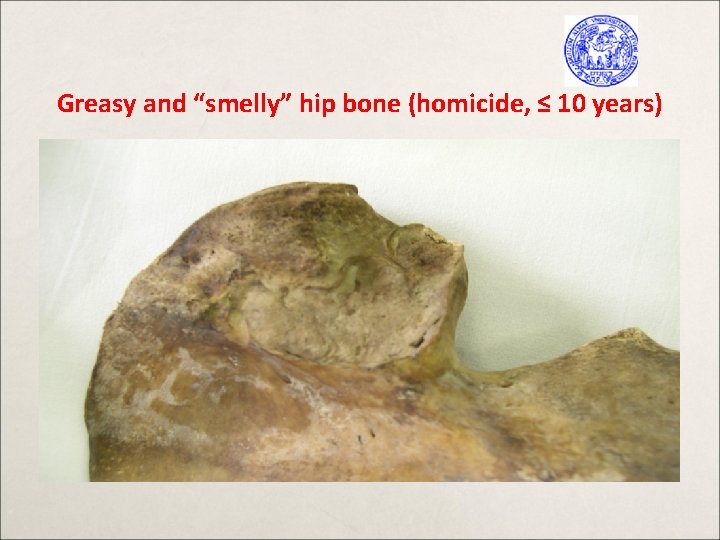 Greasy and “smelly” hip bone (homicide, ≤ 10 years) 