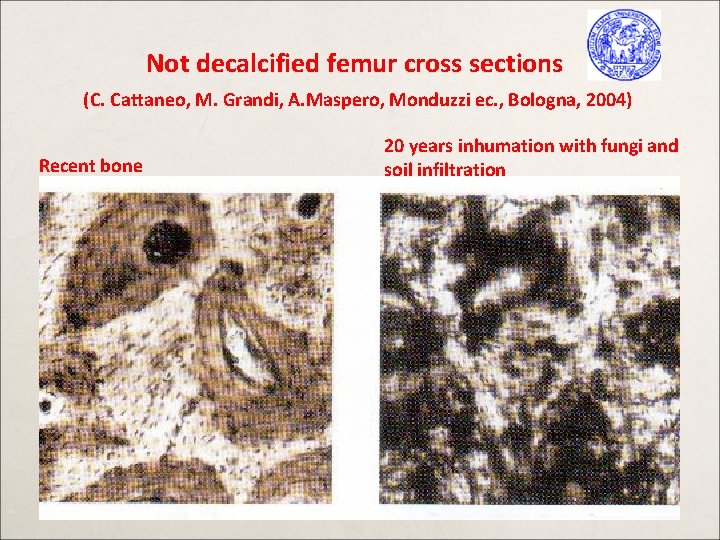 Not decalcified femur cross sections (C. Cattaneo, M. Grandi, A. Maspero, Monduzzi ec. ,
