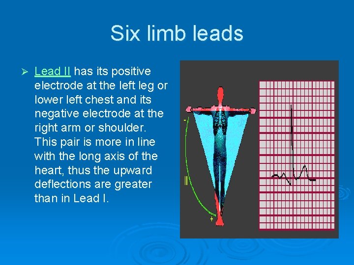Six limb leads Ø Lead II has its positive electrode at the left leg