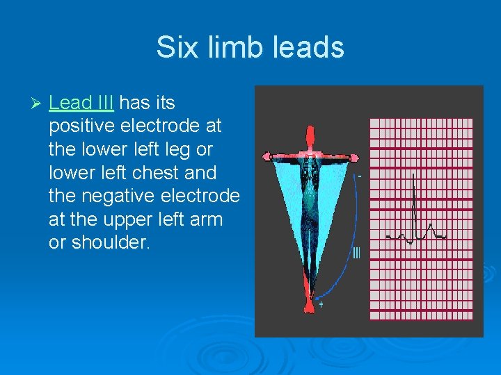 Six limb leads Ø Lead III has its positive electrode at the lower left