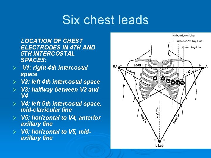 Six chest leads Ø Ø Ø LOCATION OF CHEST ELECTRODES IN 4 TH AND