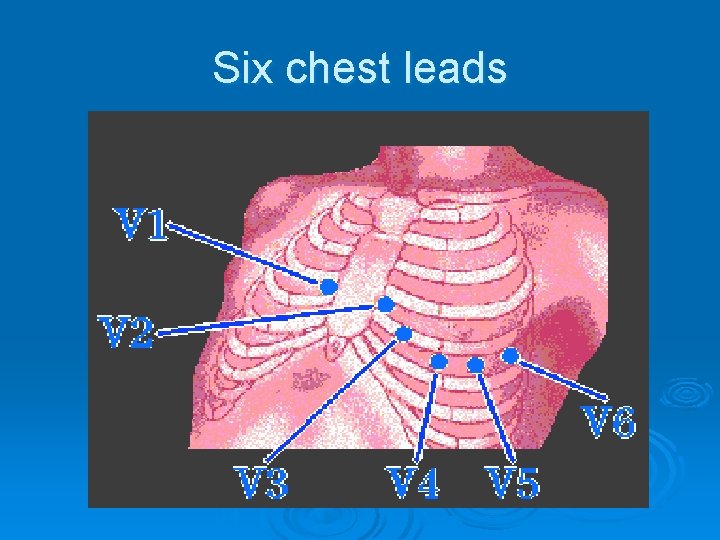 Six chest leads 
