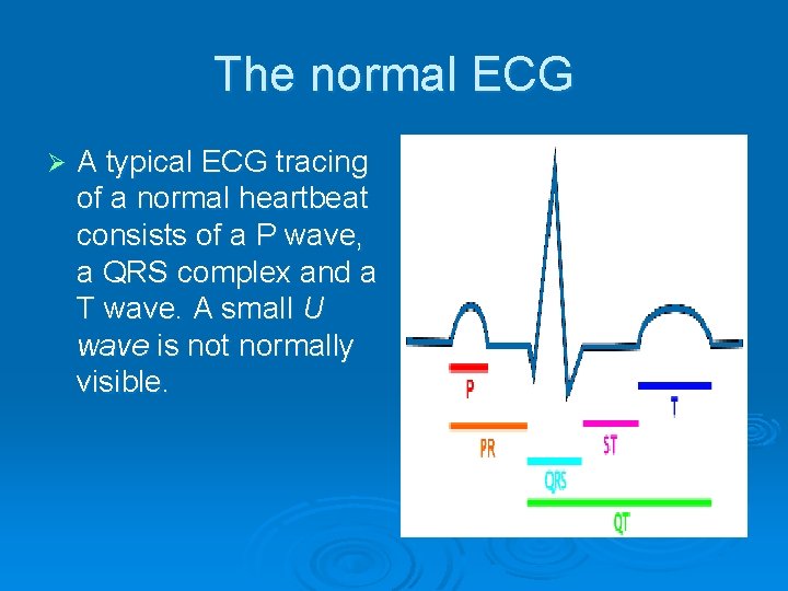 The normal ECG Ø A typical ECG tracing of a normal heartbeat consists of