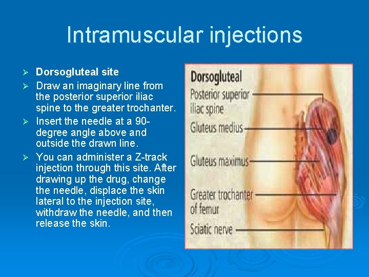 Intramuscular injections Dorsogluteal site Ø Draw an imaginary line from the posterior superior iliac