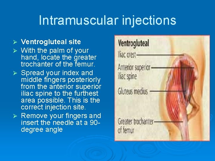 Intramuscular injections Ø Ø Ventrogluteal site With the palm of your hand, locate the