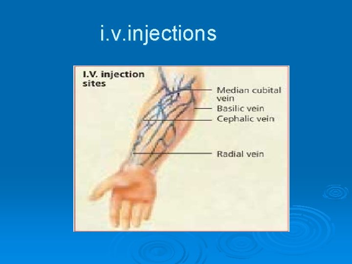 i. v. injections 