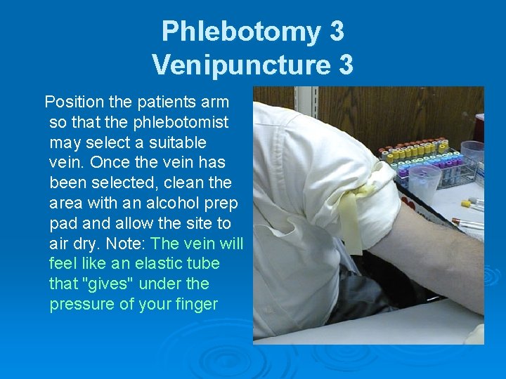 Phlebotomy 3 Venipuncture 3 Position the patients arm so that the phlebotomist may select