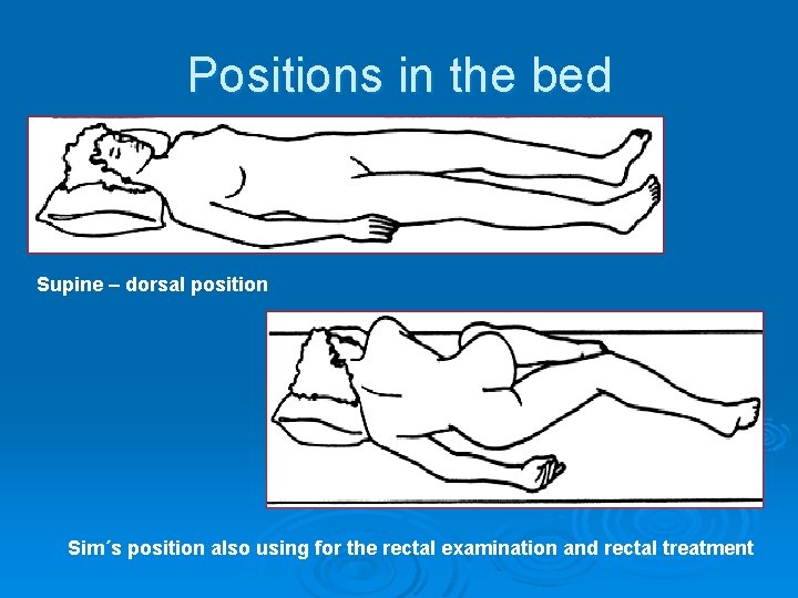 Positions in the bed Supine – dorsal position Sim´s position also using for the