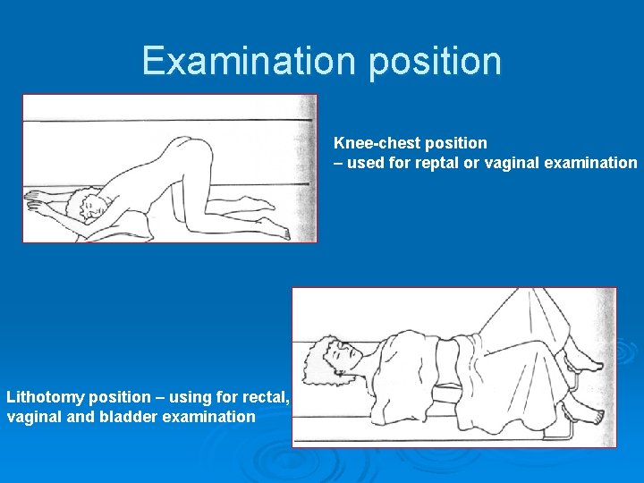 Examination position Knee-chest position – used for reptal or vaginal examination Lithotomy position –