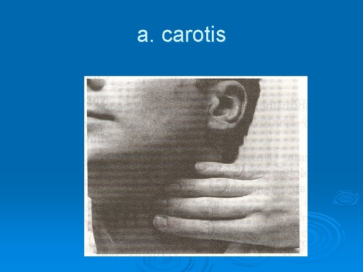 a. carotis 