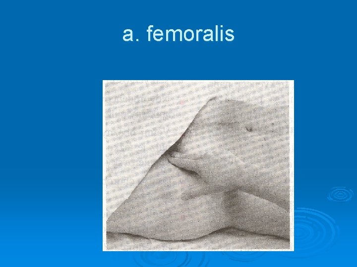 a. femoralis 