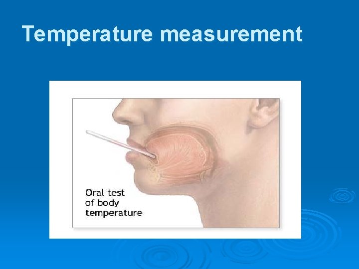 Temperature measurement 