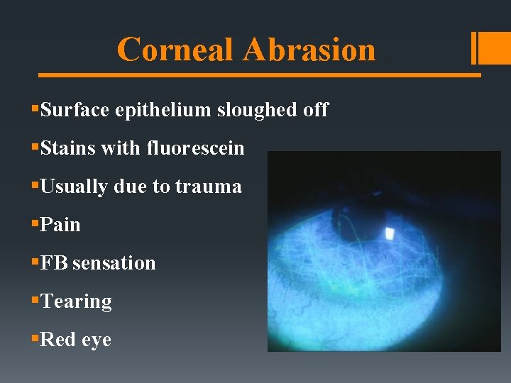 Corneal Abrasion §Surface epithelium sloughed off §Stains with fluorescein §Usually due to trauma §Pain Corneal Abrasion §Surface epithelium sloughed off §Stains with fluorescein §Usually due to trauma §Pain
