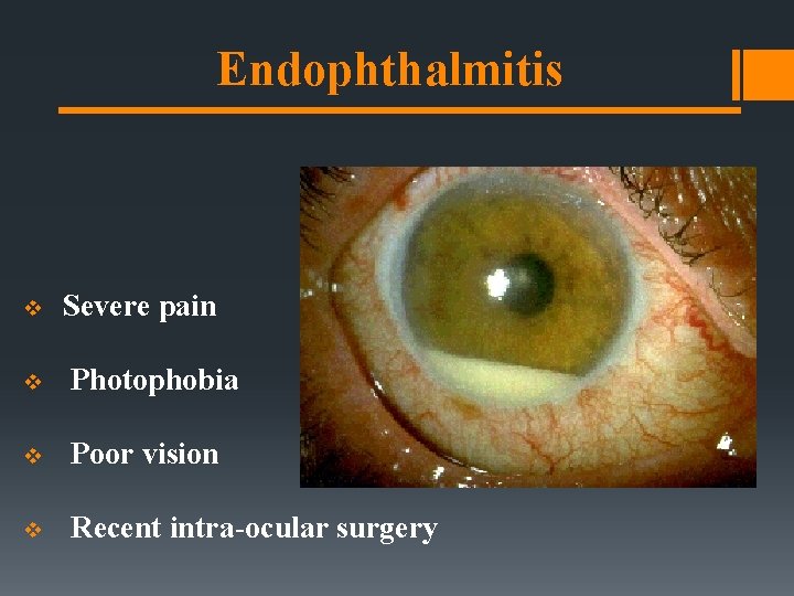 Endophthalmitis v Severe pain v Photophobia v Poor vision v Recent intra-ocular surgery Endophthalmitis v Severe pain v Photophobia v Poor vision v Recent intra-ocular surgery