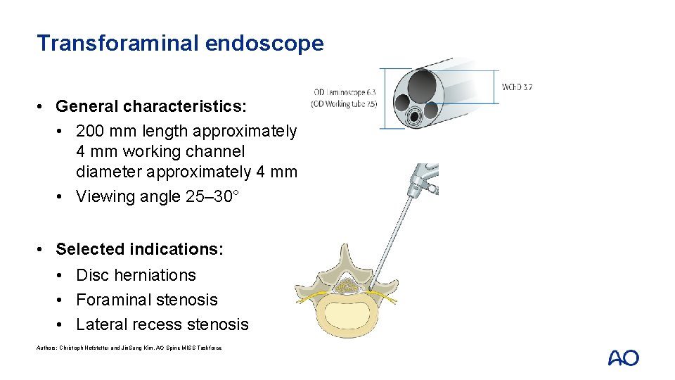 Transforaminal endoscope • General characteristics: • 200 mm length approximately 4 mm working channel