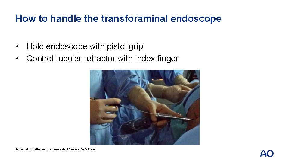 How to handle the transforaminal endoscope • Hold endoscope with pistol grip • Control