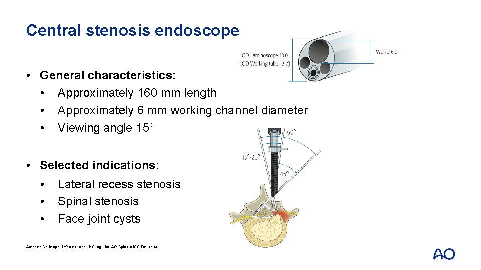Central stenosis endoscope • General characteristics: • Approximately 160 mm length • Approximately 6