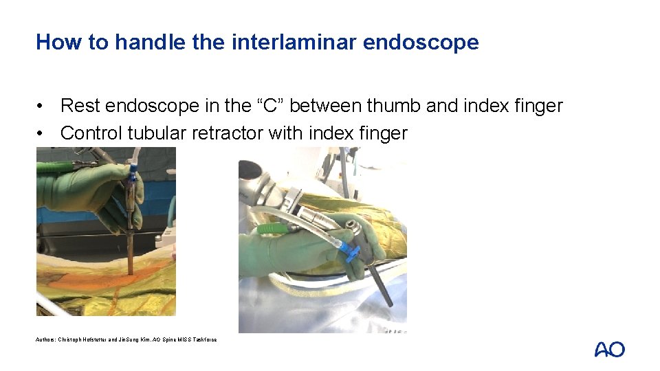 How to handle the interlaminar endoscope • Rest endoscope in the “C” between thumb