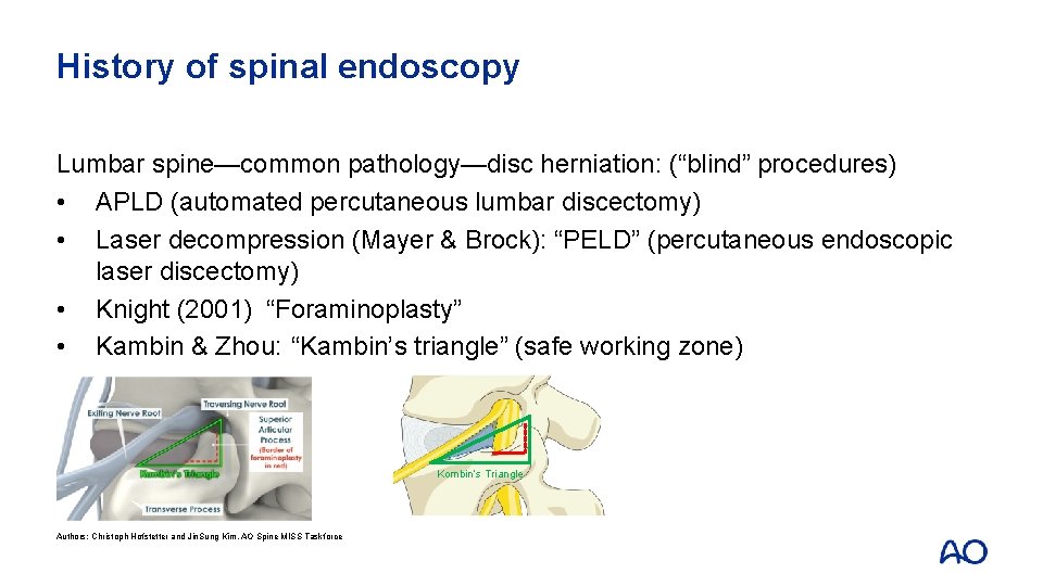 History of spinal endoscopy Lumbar spine—common pathology—disc herniation: (“blind” procedures) • APLD (automated percutaneous