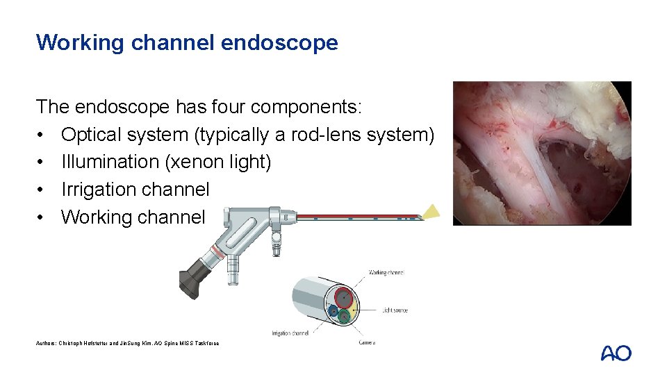 Working channel endoscope The endoscope has four components: • Optical system (typically a rod-lens