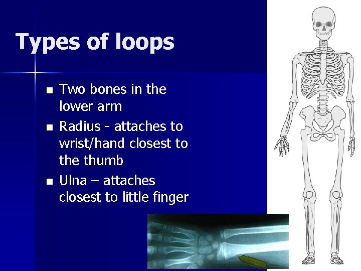 Types of loops n n n Two bones in the lower arm Radius -