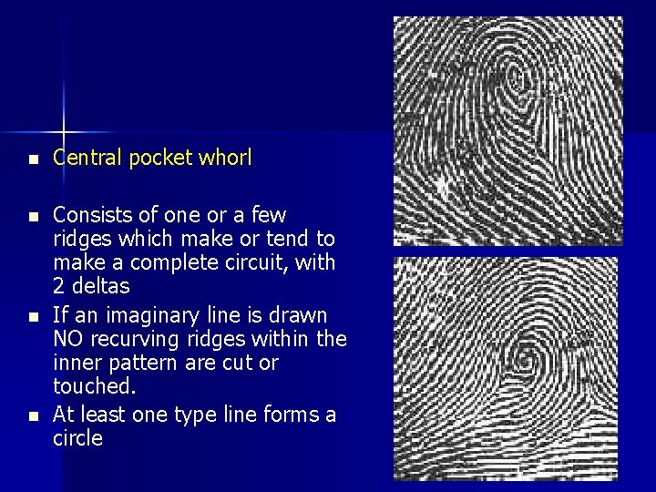 n Central pocket whorl n Consists of one or a few ridges which make
