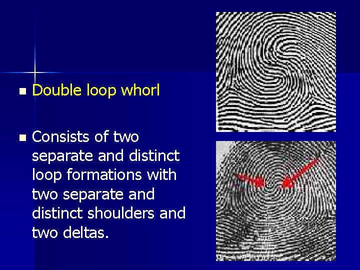 n Double loop whorl n Consists of two separate and distinct loop formations with