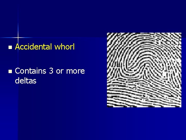 n Accidental whorl n Contains 3 or more deltas 