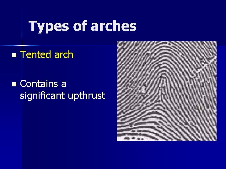 Types of arches n Tented arch n Contains a significant upthrust 