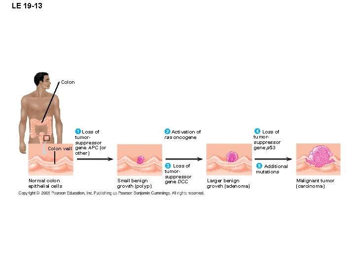 LE 19 -13 Colon Normal colon epithelial cells Loss of tumorsuppressor gene p 53