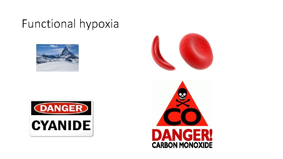 Functional hypoxia 