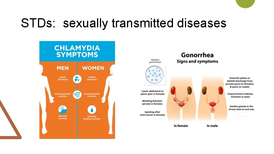 STDs: sexually transmitted diseases 