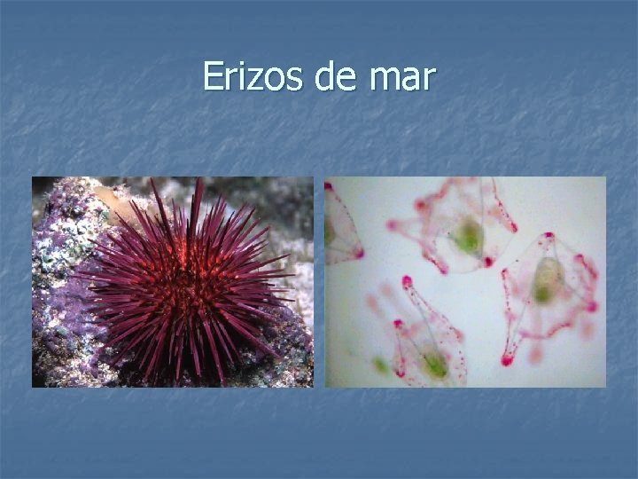 Erizos de mar 